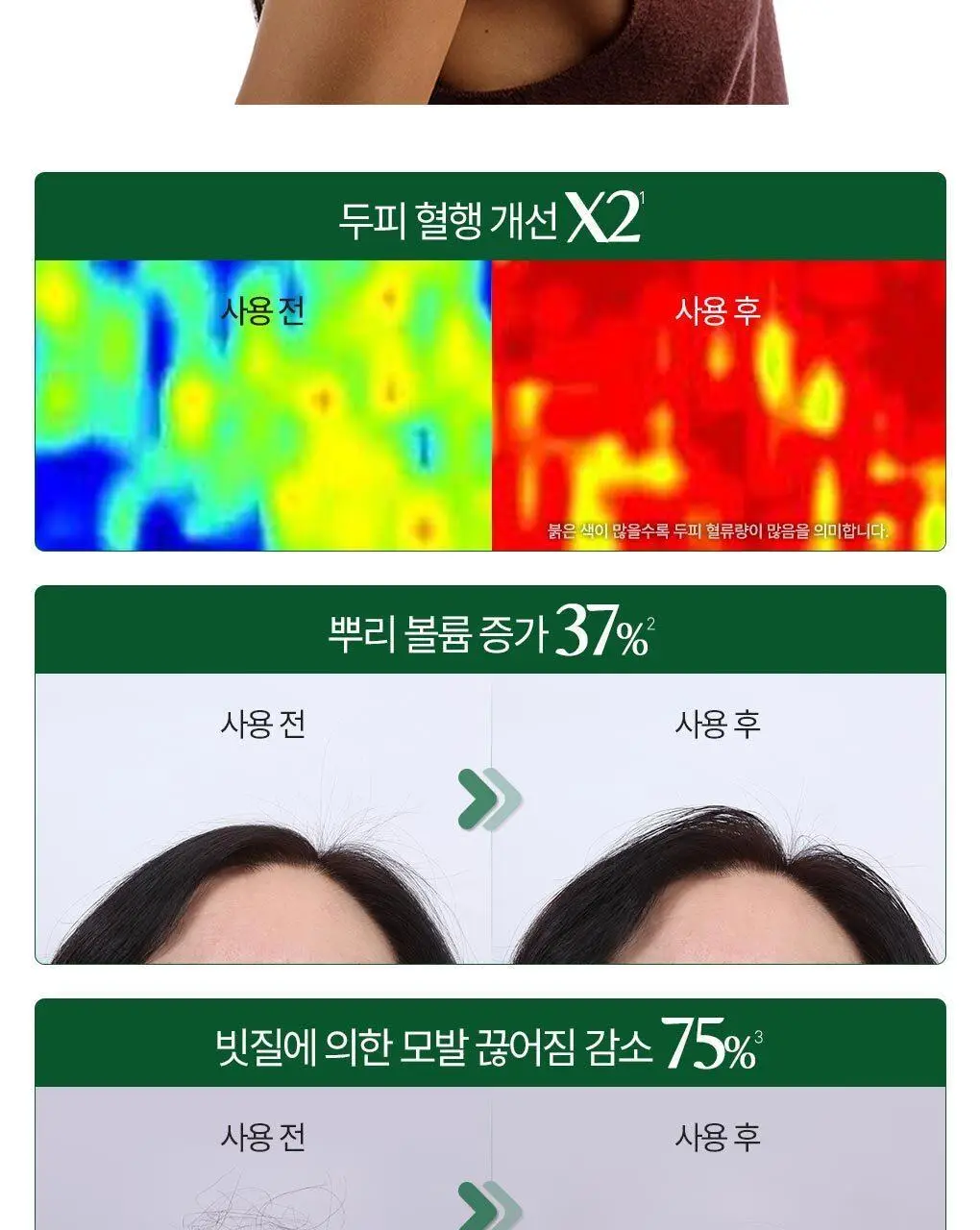 [두피 안티에이징 앰플] 클로란 퀴닌 두피 세럼100ml(NEW) 상세페이지 13